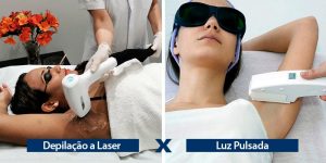 Principais diferenças entre Depilação a Laser e Luz Pulsada