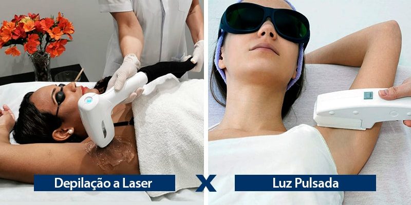 Diferenças entre Depilação a Laser e Luz Pulsada