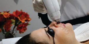 5 motivos para optar pela depilação a laser no rosto
