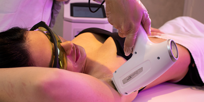 Mulher realizando sessão na axila com aparelho de laser para depilação Crystal 3D Plus