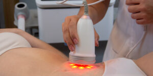 Mulher realizando tratamento com um dos melhores aparelhos de ultrassom para gordura localizada